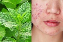 5 mẹo làm đẹp da và tóc với bạc hà