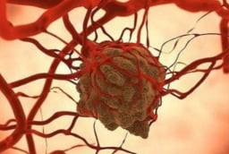 Tế bào ung thư sợ nhất điều gì? Chuyên gia chỉ ra loạt “điểm yếu chí mạng” ngăn chặn và tiêu diệt ung thư