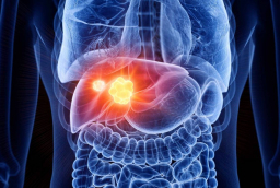 Ung thư gan gia tăng đáng báo động: Bác sĩ chỉ ra 4 thực phẩm phá gan còn nhanh hơn rượu bia