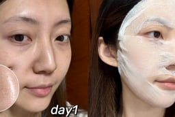 Blogger 28 tuổi dưỡng trắng da, mờ thâm nám nhờ routine khoa học tại nhà