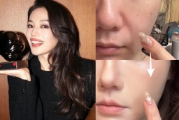 Bí quyết che rãnh cười giúp Thư Kỳ giữ vẻ trẻ trung ở tuổi 50 khiến cộng đồng làm đẹp chú ý