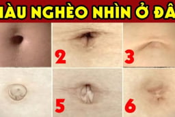 Nhìn tướng rốn biết tương lai bạn giàu sang hay nghèo khổ