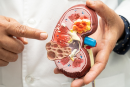 5 biểu hiện vào ban đêm cảnh báo suy thận giai đoạn sớm