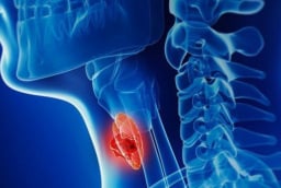 7 dấu hiệu cảnh báo ung thư tuyến giáp giai đoạn 1: Biết sớm có thể chữa khỏi hoàn toàn