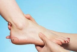 4 nốt ruồi trên bàn chân mang lại may mắn: Đừng dại xóa đi