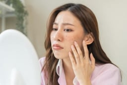 3 sai lầm chăm sóc da nhiều người mắc phải vào mùa hè khiến da đổ dầu, nổi mụn và nhanh lão hóa