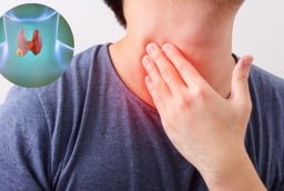 5 dấu hiệu u tuyến giáp đang âm thầm phát triển, nhiều người bỏ qua
