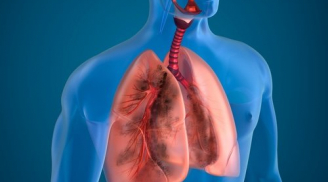 4 cách làm SẠCH BÁCH cặn bã trong phổi, phòng tránh mầm mống ung thư cực kì hiệu quả