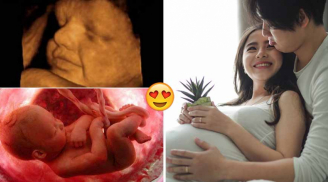 5 đặc điểm của mẹ bầu di truyền sang con, thai nhi thông minh nhanh nhẹn từ trong bụng mẹ