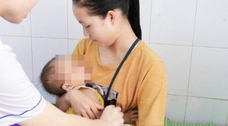 Bé gái 15 tháng tuổi bị ngã vào mảnh bát sứ vỡ, bị cắt rách từ môi đến má