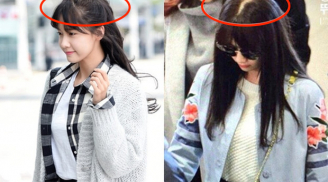 Mắc 2 lỗi cơ bản trong chăm sóc tóc bảo sao Yoona tóc mỏng dính lại còn lộ cả mảng da đầu