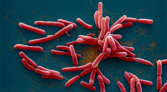 Phát hiện một trường hợp mắc 'vi khuẩn ăn thịt người' ở Hà Nội