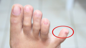 Nhìn vào điểm này là biết ngay thận khỏe hay không