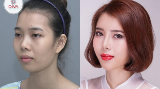 Thẩm mỹ quốc tế Diva với một nguyên tắc kỳ lạ - không chiều theo đòi hỏi của khách hàng