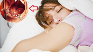 Nằm mơ thấy mình bị rụng răng, hãy cẩn thận với điềm báo này