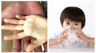 Cho con uống nhiều sữa tưởng là tốt, ai ngờ cha mẹ đang hại con mà không biết