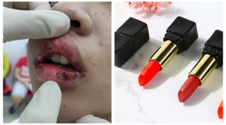 Nữ sinh rỉ máu môi vì mua son trên mạng: BS da liễu khuyên 8 món mỹ phẩm không nên mua