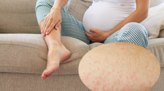Mẹ bầu mang thai 3 tháng giữa nếu thấy có 3 biểu hiện này khi ngủ hãy kiểm tra ngay sức khỏe thai nhi