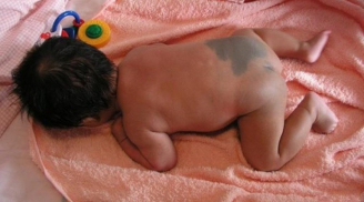 Sự hình thành những vết bớt xanh trên cơ thể trẻ sơ sinh và ý nghĩa mà ít ai biết