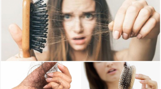 7 nguyên nhân chính gây rụng tóc, coi chừng bệnh lý tiềm ẩn