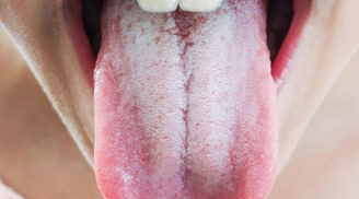 Tim khỏe hay không nhìn vào lưỡi sẽ rõ: Thấy 3 dấu hiệu này ở lưỡi thì đi khám ngay