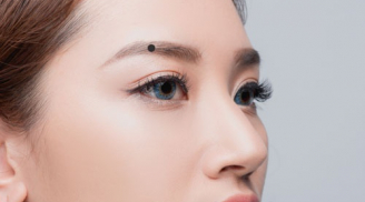 3 vị trí nốt ruồi không lo thiếu tiền: Có 1/3 cũng yên tâm vui sống