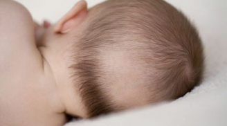 Cơ thể trẻ thiếu canxi sẽ phát đi 5 tín hiệu: Bổ sung món này để con phát triển chiều cao, hết còi cọc