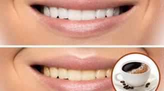 8 bí kíp giúp răng luôn trắng sáng dù uống cà phê mỗi ngày