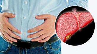 5 dấu hiệu bất thường vào buổi sáng chứng tỏ bệnh gan đã 'tìm đến': Xem bạn có điểm nào không