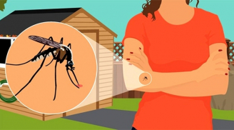 9 mẹo đơn giản giúp bạn tránh được muỗi đốt một cách hiệu quả