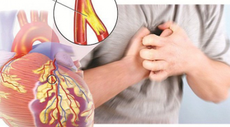 4 dấu hiệu cơ thể nhắc bạn hãy cẩn thận kẻo bệnh tim mạch ghé thăm