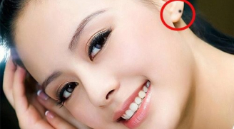 3 nốt ruồi may mắn, thịnh vượng ai có 1/3 cũng giàu sang cả đời: Hôn nhân viên mãn, con cái giỏi giang