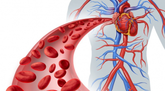 6 thực phẩm 'lọc sạch' mạch máu, ngăn ngừa bệnh tim
