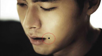 7 nốt ruồi trên khuôn mặt nam giới: Vừa mất thẩm mỹ, vừa khiến vận số lao đao