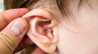 5 nốt ruồi ở trẻ nhỏ báo hiệu phúc khí cao sang, hậu vận viên mãn: Có 1/5 cũng may mắn hơn người