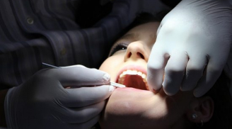 Chảy máu chân răng là dấu hiệu của 5 bệnh nguy hiểm, chớ nên xem thường