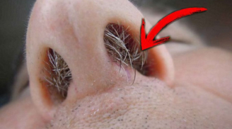 Bất kể nam nữ, lông ba chỗ trên cơ thể đều rất quan trọng, đừng tiện tay mà nhổ bỏ