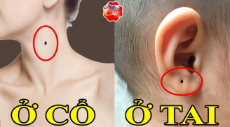 5 nốt ruồi thần Tài đánh dấu, ai có 1/5 cái cũng tha hồ hưởng phúc