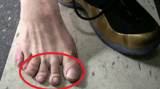 Ngón chân thứ hai dài hơn ngón cái, lớn lên sống bạc bẽo, liệu có đúng?