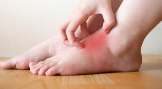 Cơ thể có 2 chỗ “ngứa” bất thường, nguy cơ mắc bệnh “tiểu đường' rất cao: Nhiều người lầm tưởng bệnh ngoài da