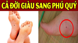 5 nốt ruồi quý hơn vàng, ai có 1/5 cái số giàu sang hết nấc