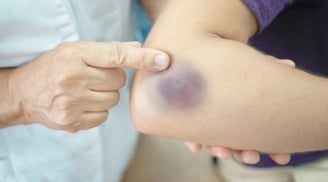 7 tín hiệu ngủ dậy thấy chứng tỏ cơ thể đang âm thầm “nuôi” tế bào K