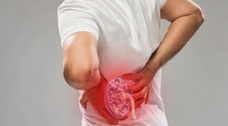 Thận yếu là gì? Cách nhận biết thận khỏe hay yếu không nên bỏ qua