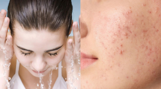5 thói quen khiến lỗ chân lông to ra mà bạn không ngờ tới
