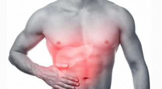 4 dấu hiệu cảnh báo gan của bạn đang kêu cứu ở giai đoạn nặng: Có 1 cũng nên đi khám sớm