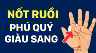 5 nốt ruồi trên tay Ăn May Cả Đời, có 1/5 cũng sướng