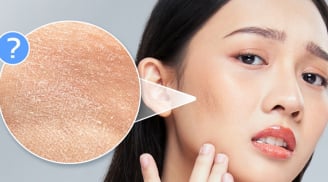 Cách để da căng bóng, mềm mịn, trời khô lạnh không lo nứt nẻ