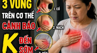 3 vùng trên cơ thể cảnh báo K đến sớm