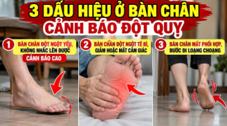 3 dấu hiệu ở bàn chân cảnh báo đột quỵ, số 1 cảnh báo cao