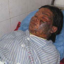 Vụ tẩm xăng đốt vợ ở Hà Tĩnh: Tuần sau sẽ lấy lời khai người chồng